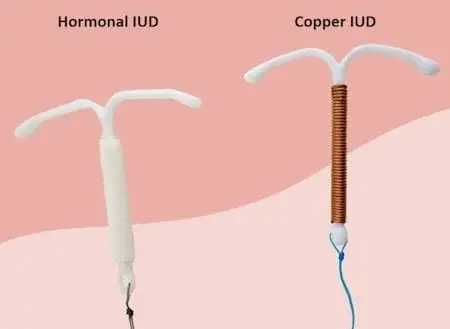 IUD-Mirena-Copper-insertions-and-Removals