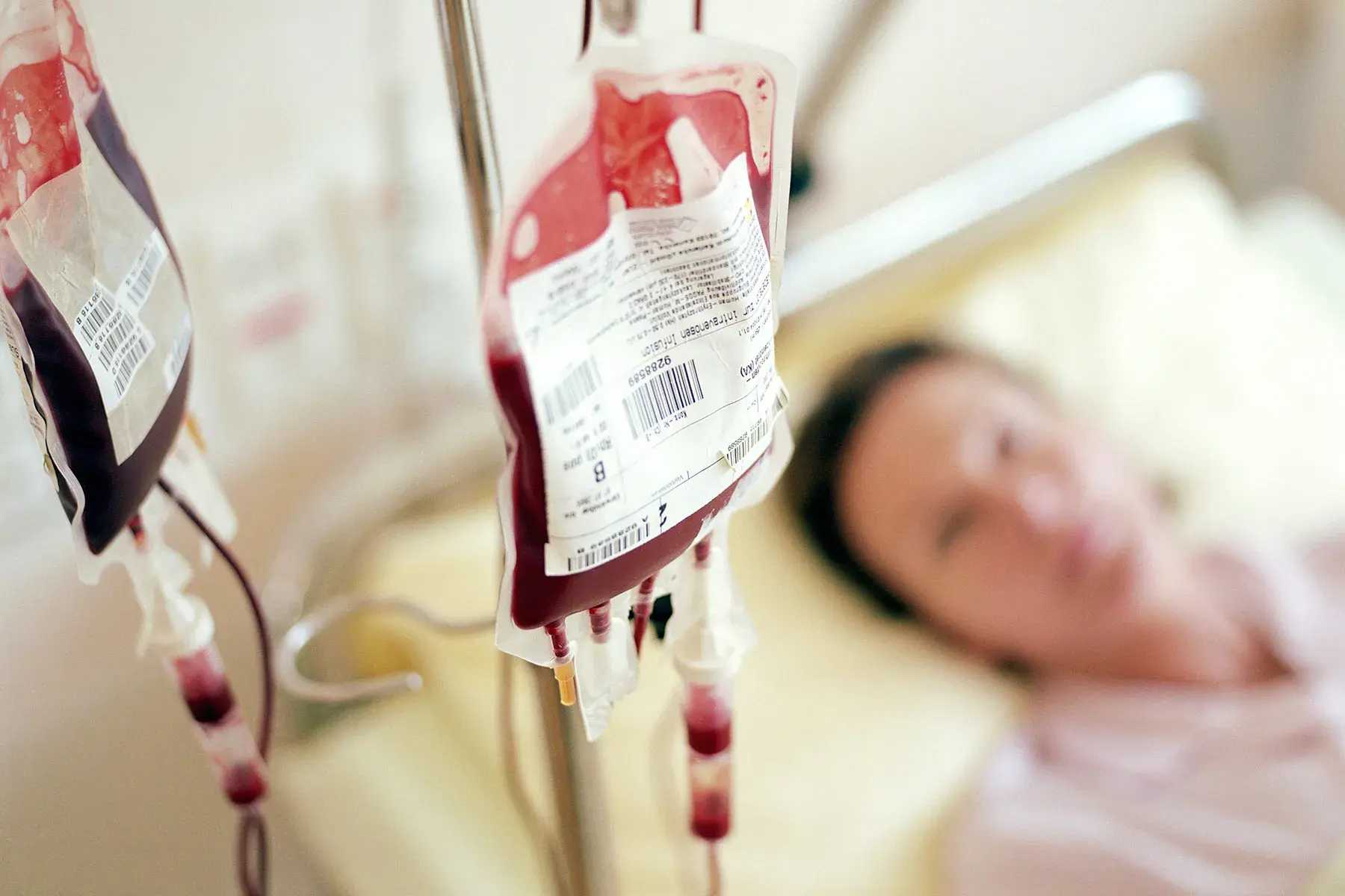 IV-iron-Infusion-1
